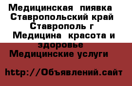 Медицинская  пиявка - Ставропольский край, Ставрополь г. Медицина, красота и здоровье » Медицинские услуги   